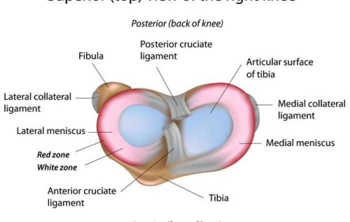 Why fix or replace a meniscus?