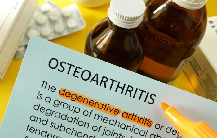 Best treatments for osteoarthritis