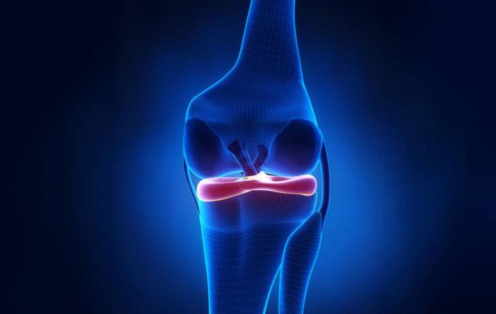 Latest Meniscus Surgery  Meniscus Digital Illustration