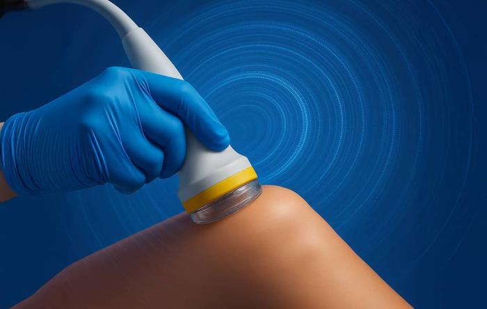 Shockwave Therapy Shockwave Therapy in San Francisco, CA