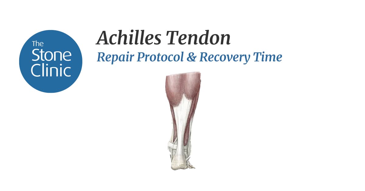 Tendon repair: Procedure, recovery, and complications