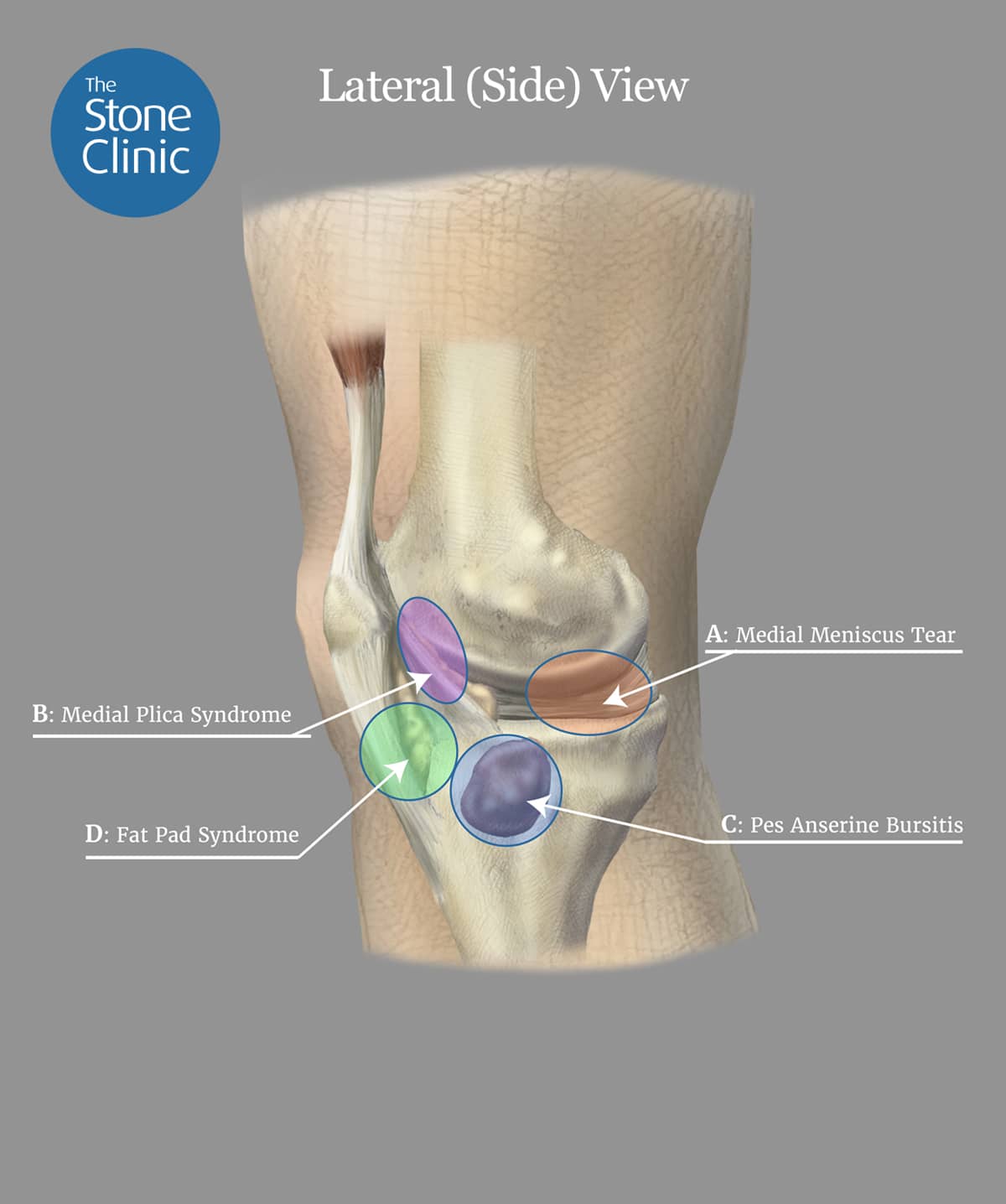 understanding-knee-pain-and-injuries-causes-treatment