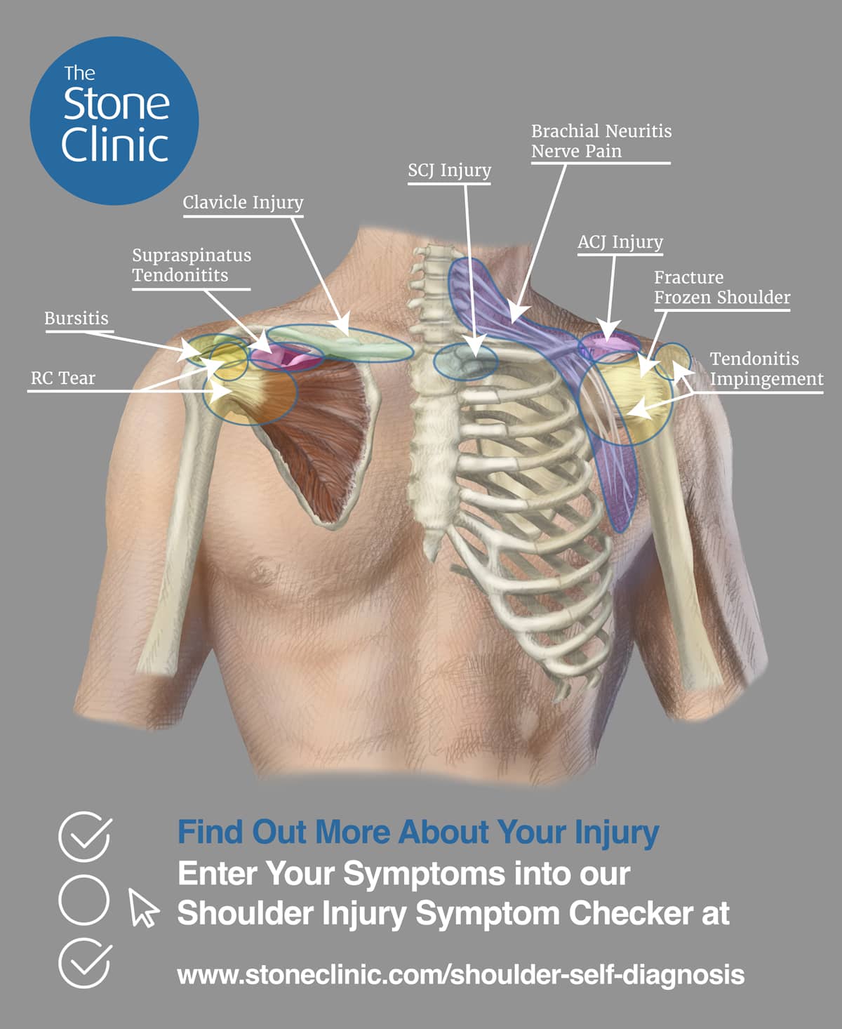 Shoulder Pain e-chart: Quick reference guide See more