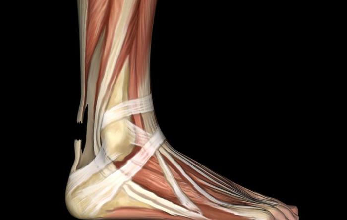 Achilles Rupture Anatomy Illustration