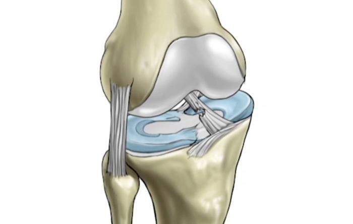 Lessons from the ACL STUDY GROUP 2023 